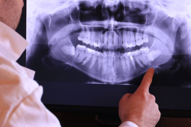 Best Dentist for Tooth Abscess  in Knoxville, TN