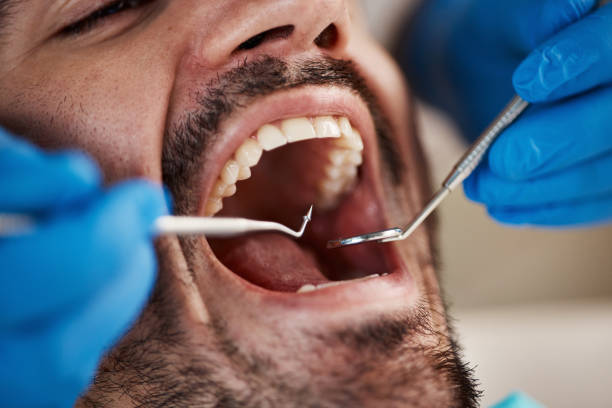 Best Chipped Tooth Repair Near Me  in Knoxville, TN